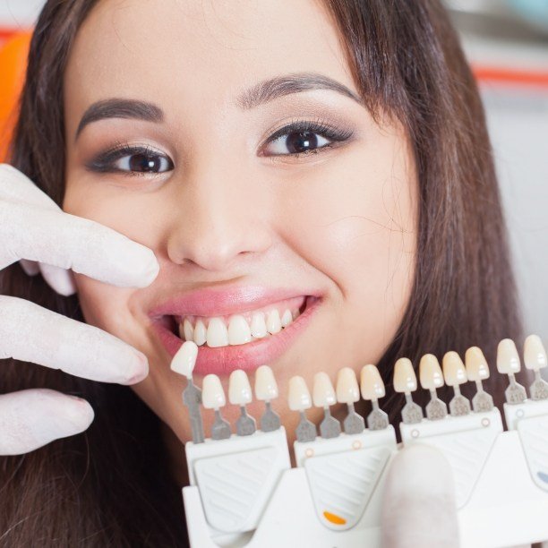 Cosmetic dentist comparing smile to veneers color chart