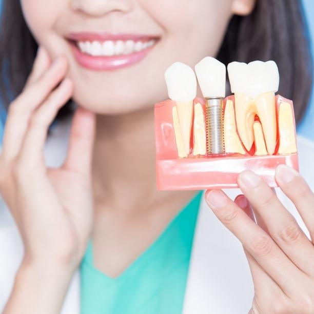 Dentist using smile model to describe the four step dental implant process