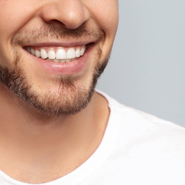 Closeup of flawless smile after tooth replacement with dental implants