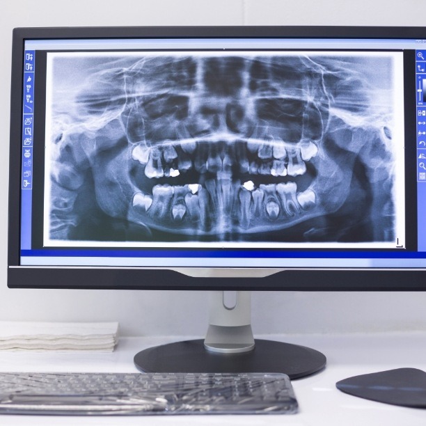 Digital smile x rays on chairside computer monitor