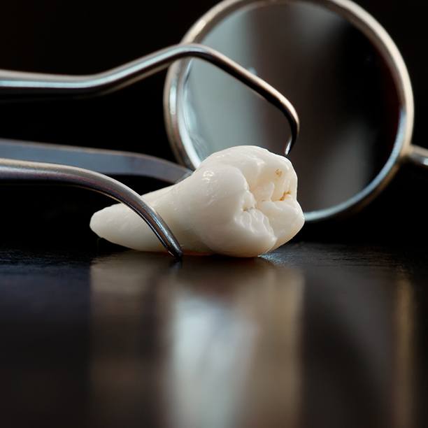 Close-up of tooth next to dental instruments after tooth extraction in Plano, TX