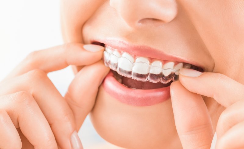 A young woman removing her clear aligners