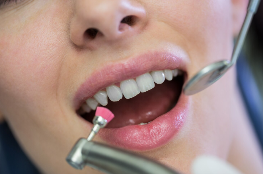 The Complete Guide to Prophylaxis Dental