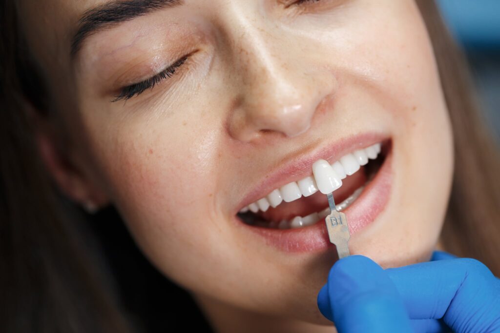 Cosmetic Dentistry in Plano TX: Veneers, Whitening and More
