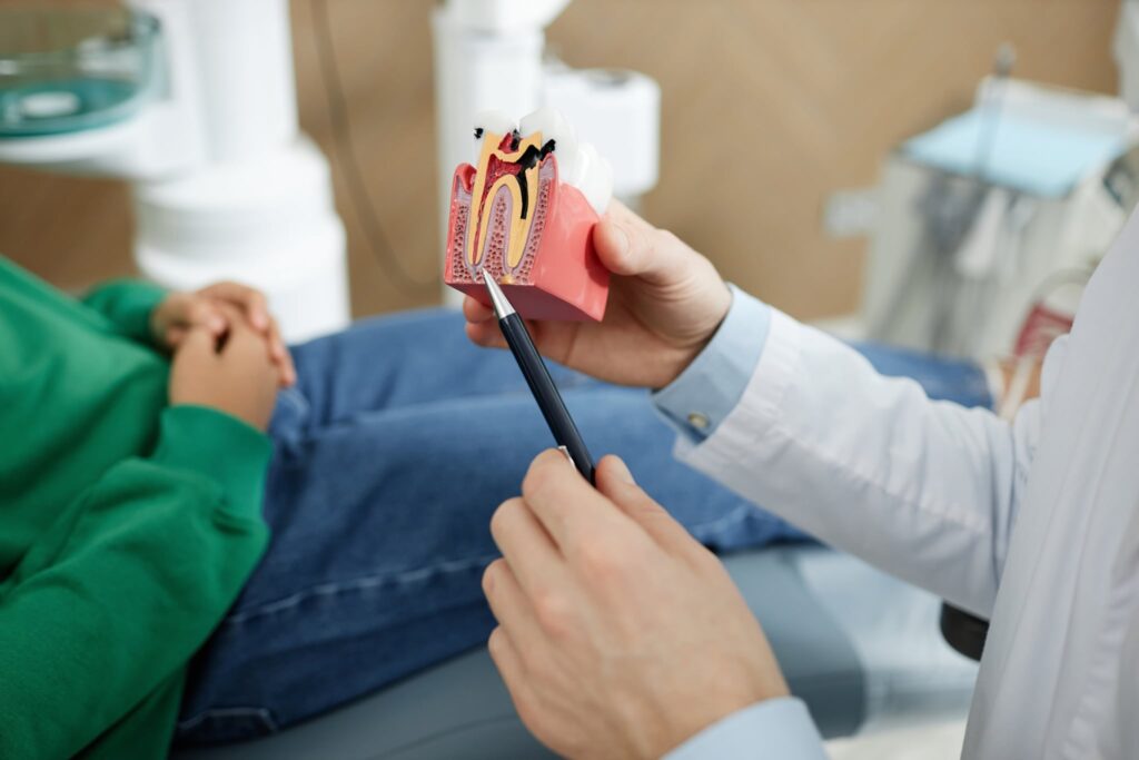 Root Canal Procedure Explained Step-by-Step