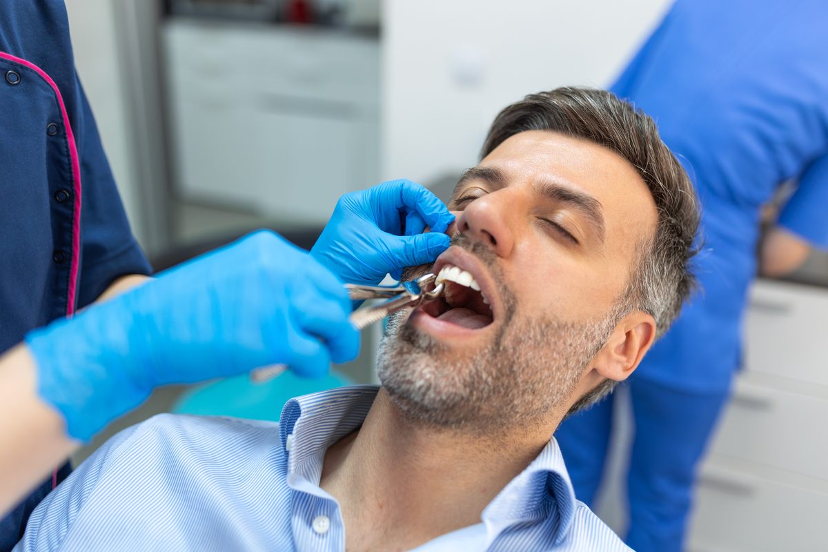 Dentist performing a tooth extraction on a relaxed patient in the dental chair