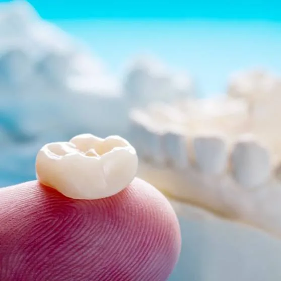 Custom dental crown restoring a natural-looking smile in Plano, TX